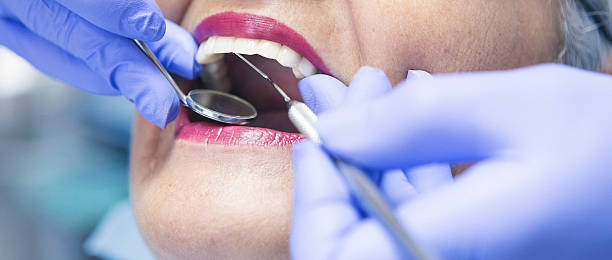 Best Chipped Tooth Repair Near Me  in Beaufort, SC